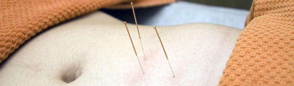 Accupuncture, Eastern Healing Arts in the Doylestown, Bucks County PA area